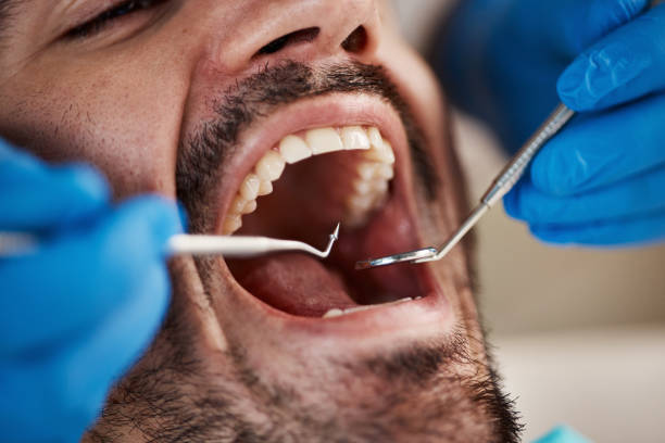 Best Weekend Emergency Dentist in Mount Pleasant, TN